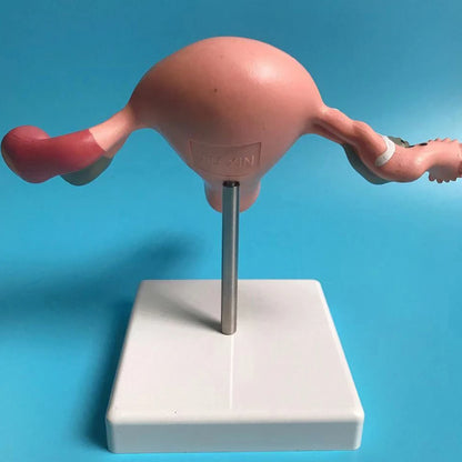 Modelo Anatômico de Útero Patológico humano para Ferramenta de Estudo
