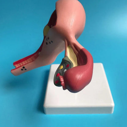 Modelo Anatômico de Útero Patológico humano para Ferramenta de Estudo